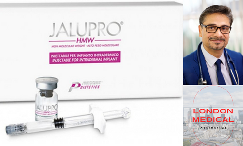 jalupro